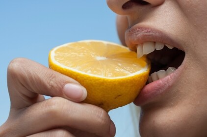 Protect your dental health in summer. (Photo by engin akyurt on Unsplash) Protect your dental health in summer. (Photo by engin akyurt on Unsplash)