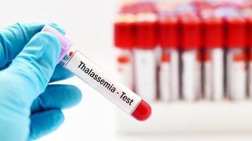 People with thalassemia produce lesser amounts of healthy haemoglobin throughout their life, and their bone marrow could even stop producing healthy red blood cells at a certain point in time. (Shutterstock) People with thalassemia produce lesser amounts of healthy haemoglobin throughout their life, and their bone marrow could even stop producing healthy red blood cells at a certain point in time. (Shutterstock)
