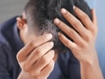 Alopecia is an autoimmune condition where one starts to lose hair in an area.