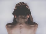 Doctor explains what is perinatal depression and how it can be treated safely. Doctor explains what is perinatal depression and how it can be treated safely.