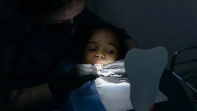 She mistakenly skipped the alginate step and directly used plaster inside the trays to make. (Representational Image/Pexel) She mistakenly skipped the alginate step and directly used plaster inside the trays to make. (Representational Image/Pexel)