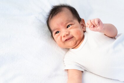 Babies have very sensitive skin. Fragrance ingredients might disrupt the delicate balance and irritate their sensitive skin. (Shutterstock) Babies have very sensitive skin. Fragrance ingredients might disrupt the delicate balance and irritate their sensitive skin. (Shutterstock)