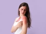 Sunburn is not the only consequence of sun exposure, there are others which are much more concerning.