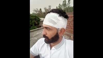 The victim, Sahil, sustained multiple injuries, including 12 stitches to his head, after being mercilessly attacked with knuckle punches and a bracelet. (HT)