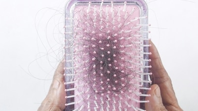 Doctor shares 3 vital tips to tackle hair loss associated with hormonal imbalance and fertility. (Image by Unsplash) Doctor shares 3 vital tips to tackle hair loss associated with hormonal imbalance and fertility. (Image by Unsplash)