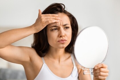 Dr. Madhurya recommends benzoyl peroxide, salicylic acid, clindamycin, and adapalene for acne treatment. (Shutterstock) Dr. Madhurya recommends benzoyl peroxide, salicylic acid, clindamycin, and adapalene for acne treatment. (Shutterstock)