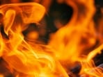 Metro Hospital staff present acted swiftly and made efforts to control the flames, preventing the fire from spreading