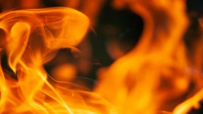 Metro Hospital staff present acted swiftly and made efforts to control the flames, preventing the fire from spreading (Representational Image)