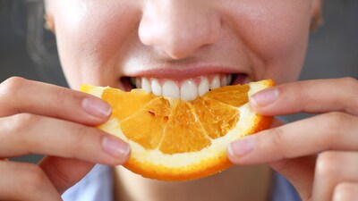 It may be surprising, but citrus fruits, just like sugar, affect your enamel. (Shutterstock) It may be surprising, but citrus fruits, just like sugar, affect your enamel. (Shutterstock)