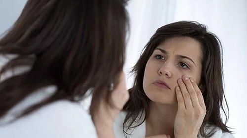 Sleep deprivation, tiredness, increased screen time, stress, dehydration or allergies may contribute to darkening of the area around your eyes. (Shutterstock) Sleep deprivation, tiredness, increased screen time, stress, dehydration or allergies may contribute to darkening of the area around your eyes. (Shutterstock)