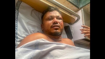 Vishwash Kumar Ramesh, the lone survivor of the Air India plane crash, receives treatment at a hospital in Ahmedabad. (PTI) Vishwash Kumar Ramesh, the lone survivor of the Air India plane crash, receives treatment at a hospital in Ahmedabad. (PTI)