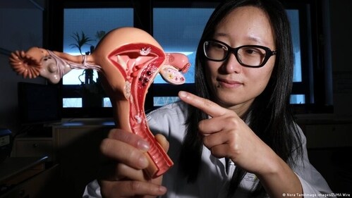 Ovarian cancer is more lethal than other types of gynaecological cancers. (Nora Tam/imago images/ZUMA Wire ) Ovarian cancer is more lethal than other types of gynaecological cancers. (Nora Tam/imago images/ZUMA Wire )