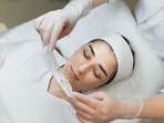 Chemical peels are suitable for most skin types, but they’re not a one-size-fits-all solution. (Freepik) Chemical peels are suitable for most skin types, but they’re not a one-size-fits-all solution. (Freepik)