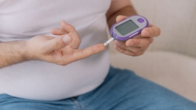 “Men are more likely to develop type 2 diabetes," said Dr. Pankaj Soni. (Shutterstock) “Men are more likely to develop type 2 diabetes," said Dr. Pankaj Soni. (Shutterstock)