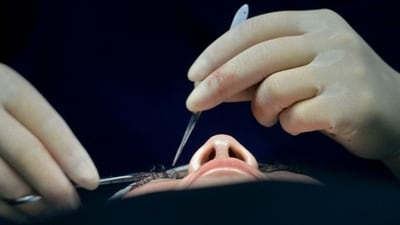 Diabetes is one of the leading causes of cataract and blindness. (AFP / Relevant Image ) Diabetes is one of the leading causes of cataract and blindness. (AFP / Relevant Image )
