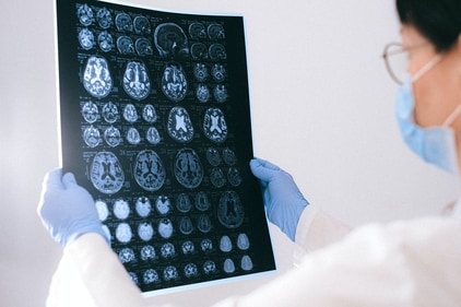 Know the early warning signs of brain tumour. (Anna Shvets) Know the early warning signs of brain tumour. (Anna Shvets)