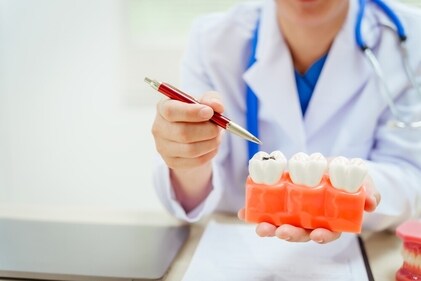 Cavity accelerates tooth decay. (Shutterstock)