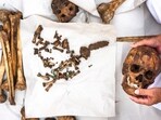 Human skull and bones found in Bengaluru. (Representational Image) Human skull and bones found in Bengaluru. (Representational Image)