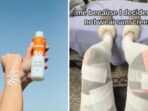She was rushed to the hospital where doctors diagnosed her with a rare and dangerous third-degree sunburn