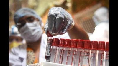 According to civic officials, this unjustified testing is leading to panic among the public besides adding to treatment costs. (REPRESENTATIVE PIC) According to civic officials, this unjustified testing is leading to panic among the public besides adding to treatment costs. (REPRESENTATIVE PIC)