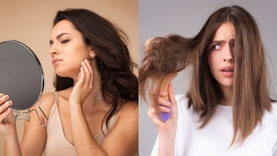 Experts share tips to manage acne and frizzy hair this monsoon season (Photos: Adobe Stock) Experts share tips to manage acne and frizzy hair this monsoon season (Photos: Adobe Stock)