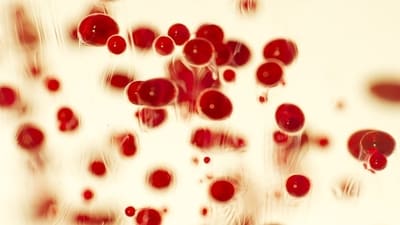 Sickle cell anaemia (Freepik) Sickle cell anaemia (Freepik)