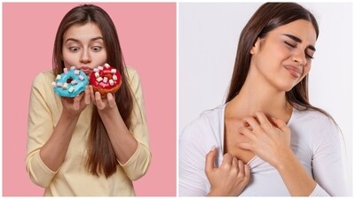 Sugar cravings and skin issues, like rashes or eczema, could be a sign of poor gut health. (Freepik) Sugar cravings and skin issues, like rashes or eczema, could be a sign of poor gut health. (Freepik)