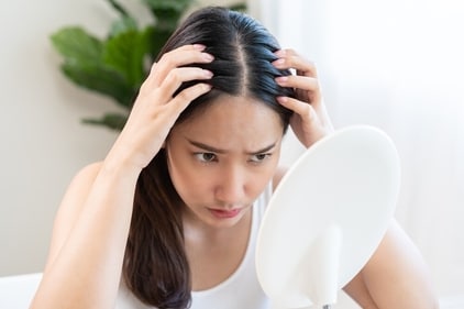 Know the symptoms of scalp psoriasis. (Shutterstock) Know the symptoms of scalp psoriasis. (Shutterstock)