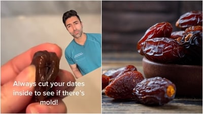 “No matter how sweet the date, always check before committing," wrote Dr Kunal Sood. (Instagram/@doctorsoood, Freepik) “No matter how sweet the date, always check before committing," wrote Dr Kunal Sood. (Instagram/@doctorsoood, Freepik)