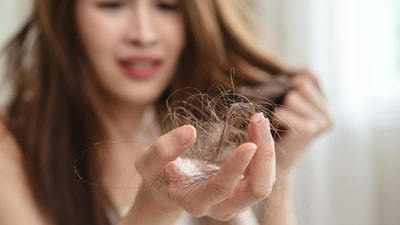 Hair loss may indicate underlying health issues. (Shutterstock) Hair loss may indicate underlying health issues. (Shutterstock)