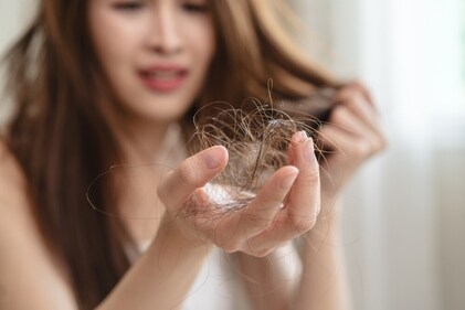 Know these myths about alopecia. (Shutterstock) Know these myths about alopecia. (Shutterstock)