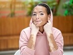 There are many myths surrounding vitiligo that need to be debunked urgently to ensure people with vitiligo have a good quality of life. There are many myths surrounding vitiligo that need to be debunked urgently to ensure people with vitiligo have a good quality of life.