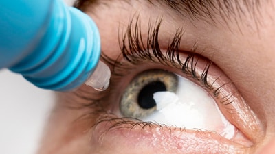 Foggy vision is one of the early symptoms of cataract. (Freepik) Foggy vision is one of the early symptoms of cataract. (Freepik)