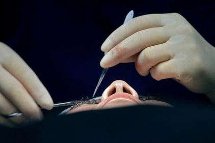 Know the early symptoms of cataract. (AFP / Relevant Image ) Know the early symptoms of cataract. (AFP / Relevant Image )