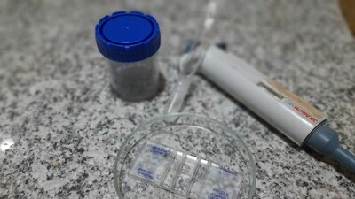 The man's consent form, he clearly stated that the sperm should be discarded if he died. (Representational Image) The man's consent form, he clearly stated that the sperm should be discarded if he died. (Representational Image)