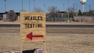 Measles It is preventable through vaccines and has been considered eliminated from the US since 2000. (Representational/AFP) Measles It is preventable through vaccines and has been considered eliminated from the US since 2000. (Representational/AFP)