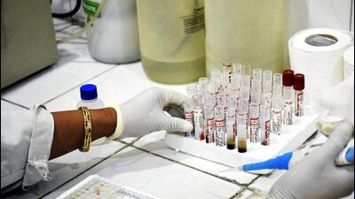 PCMC has launched probe against hospital in Wakad for allegedly charging more than ₹600 fixed by state government for dengue tests, said officials. ((PIC FOR REPRESENTATION)) PCMC has launched probe against hospital in Wakad for allegedly charging more than ₹600 fixed by state government for dengue tests, said officials. ((PIC FOR REPRESENTATION))