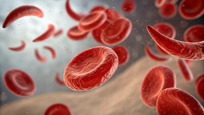 Sickle cell disease affects the way the red blood cells of the body carry oxygen. Sickle cell disease affects the way the red blood cells of the body carry oxygen.