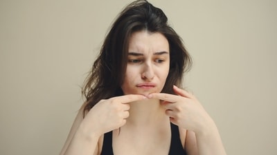 Dr. Blossom Kochhar talks about acne prone skin (Pexels) Dr. Blossom Kochhar talks about acne prone skin (Pexels)