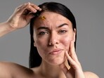 Hyperpigmentation is a common skin concern that affects many individuals, causing uneven skin tone and dark patches. Hyperpigmentation is a common skin concern that affects many individuals, causing uneven skin tone and dark patches.