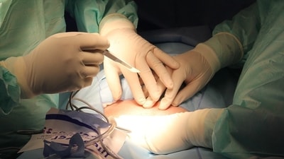 He underwent surgery at Max Super Speciality Hospital in Saket (Representational image) He underwent surgery at Max Super Speciality Hospital in Saket (Representational image)