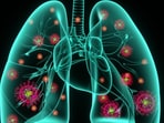 Understanding COVID-19 Risks