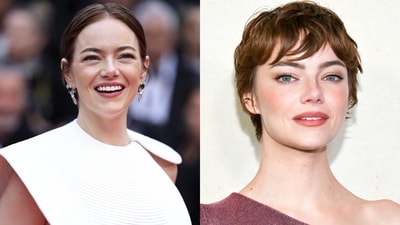 Emma Stone: Before and after the alleged cosmetic procedures (Photos: X) Emma Stone: Before and after the alleged cosmetic procedures (Photos: X)