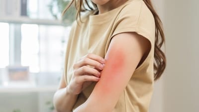 Here's why you need to stop self-diagnosing your skin conditions. (Shutterstock) Here's why you need to stop self-diagnosing your skin conditions. (Shutterstock)