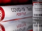 The CDS is monitoring the spread of his virus through an airport screening program