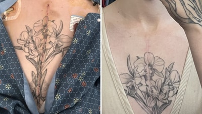 Anna praised her doctor for meticulously repairing her chest tattoo during the procedure (X/@frogs4girls)