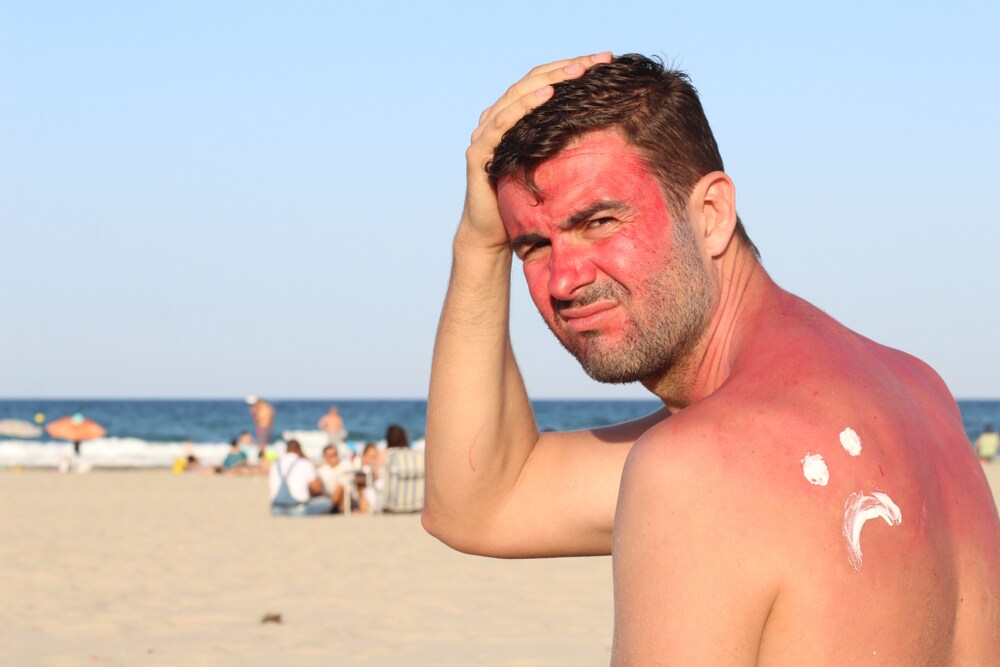 Men often don't apply sunscreen as much, causing bad sun damage. (Shutterstock) Men often don't apply sunscreen as much, causing bad sun damage. (Shutterstock)