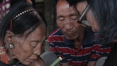 Japanese Encephalitis (JE) cases surge in Nagaland (Representative image)