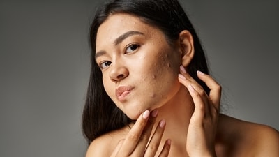 Underlying health issues often surface as skin problems. (Shutterstock) Underlying health issues often surface as skin problems. (Shutterstock)