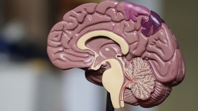 Neurologist lists foods to avoid for better mental fitness. Neurologist lists foods to avoid for better mental fitness.